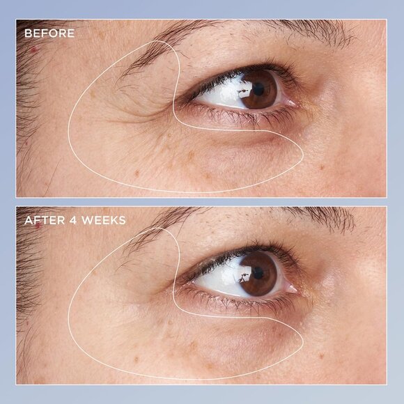 Perricone Md High Potency Triple Retinol Renewal Eye Serum - Picture 4 of 7